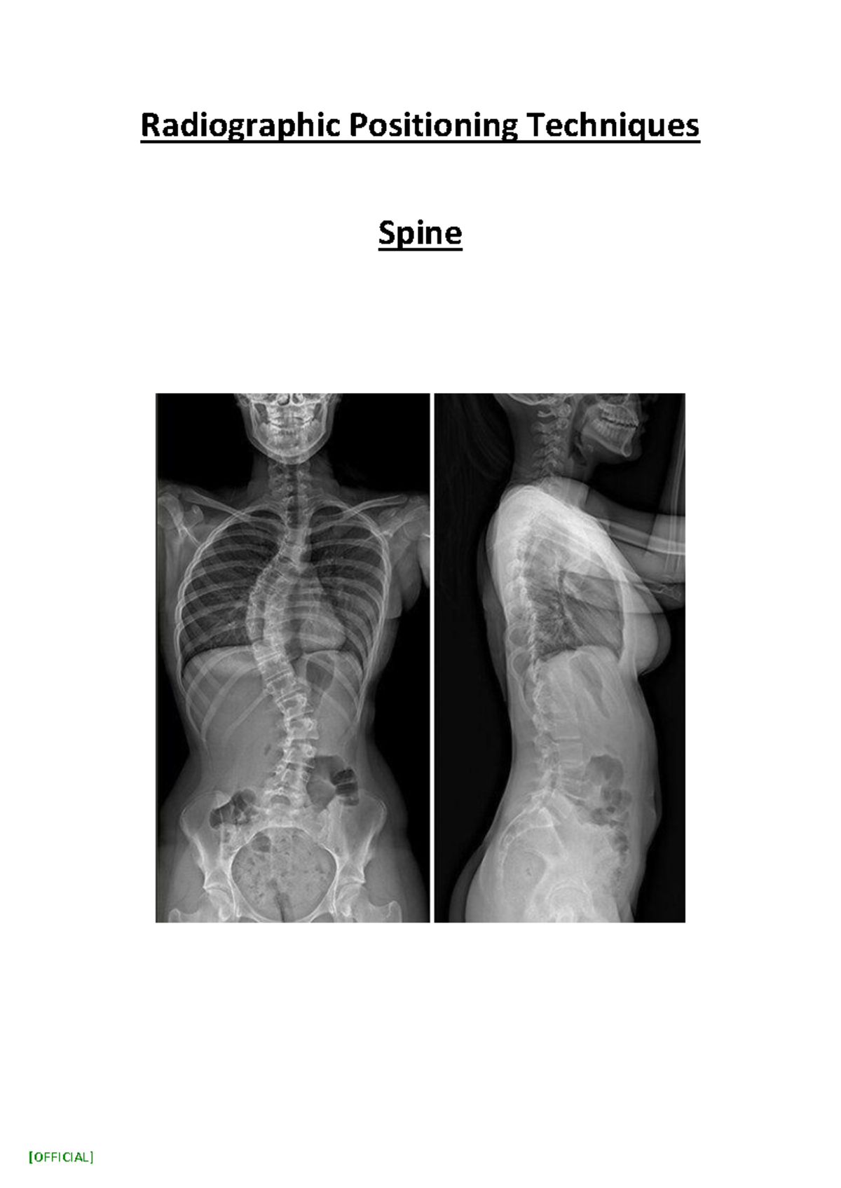 Radiographic Positioning Techniques for Spine: CHI441 Guide - Studocu
