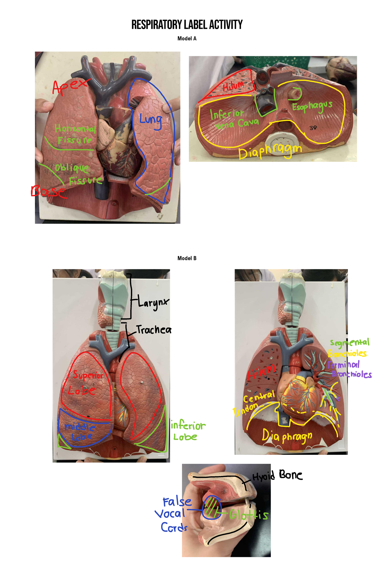 Respiratory System Labeled Models - Radiology - Respiratory Label ...
