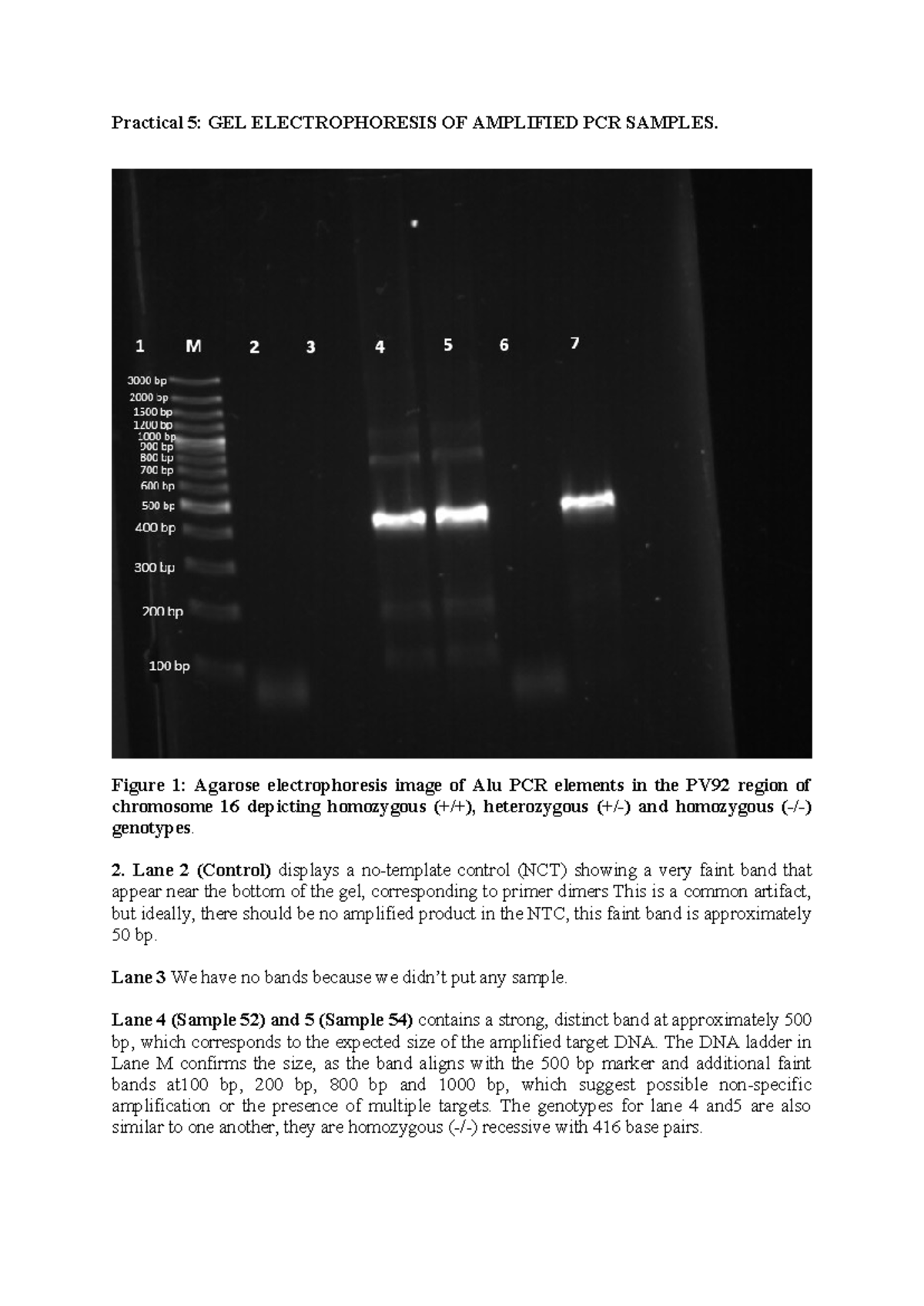 Practical 5: Gel Electrophoresis of PCR Samples Analysis - Studocu