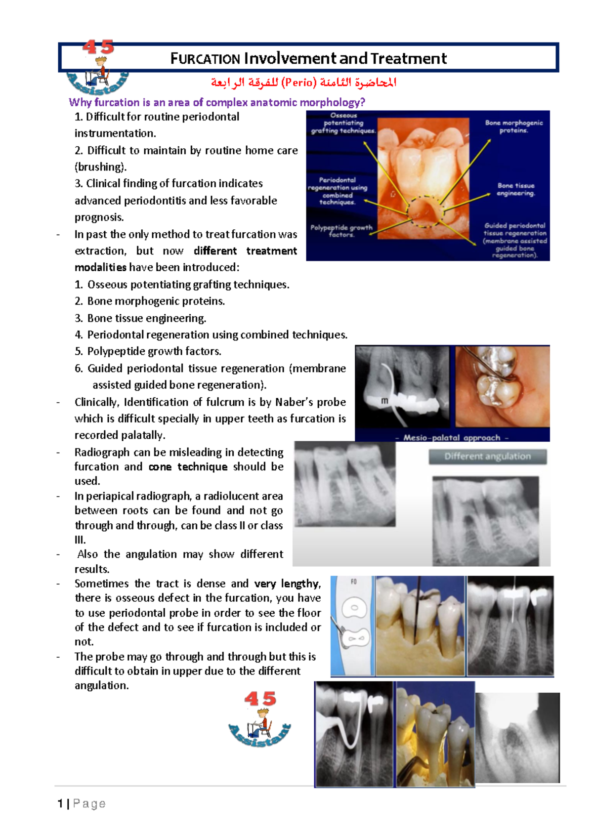 08 - Furcation Involvement: Diagnosis & Advanced Treatment Options ...