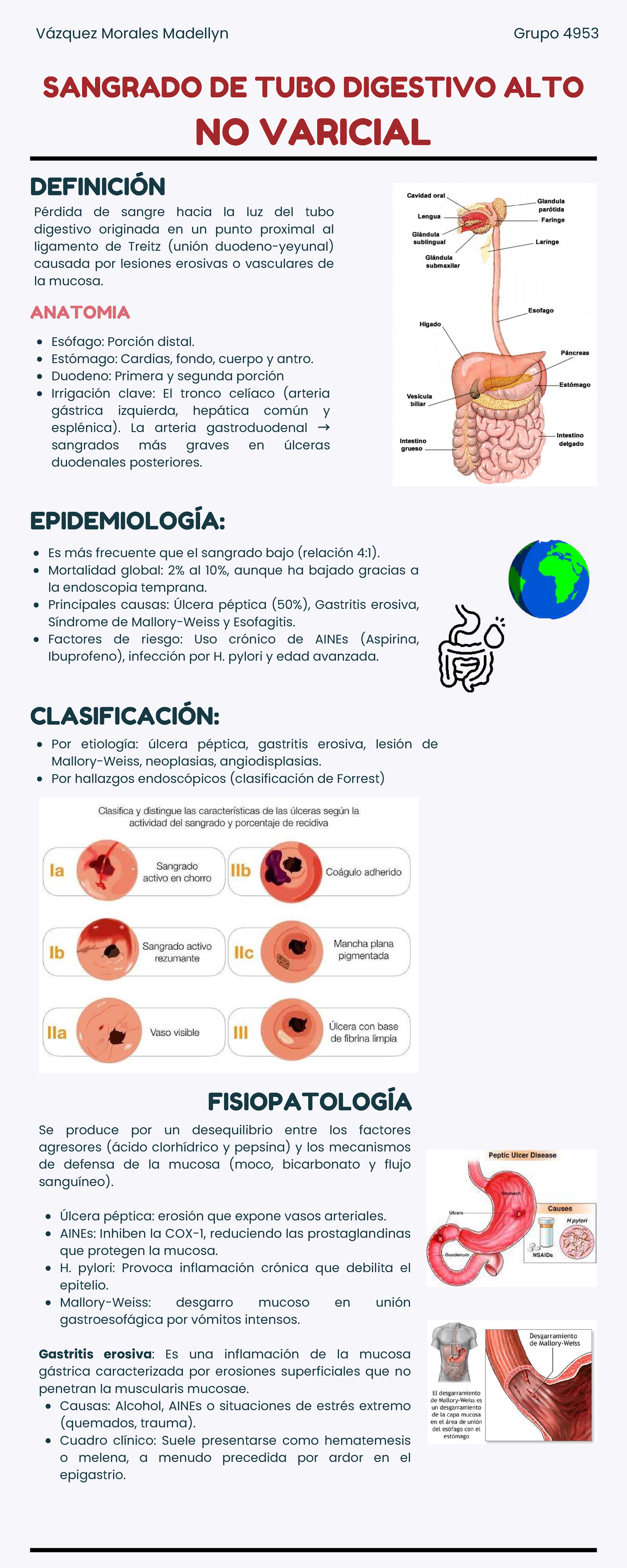 Infografía sobre Sangrado de Tubo Digestivo Alto NO Varicial - Grupo