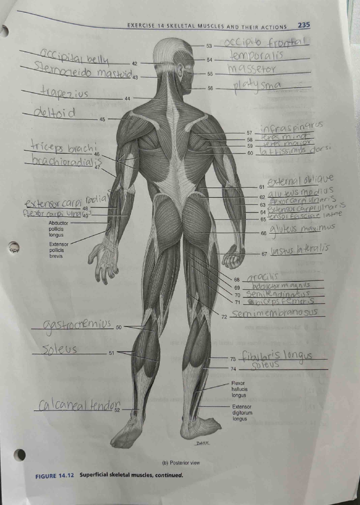 Anatomy review 2 - ####### EXERCISE 14 SKELETAL MUSCLES AND THEIR ...