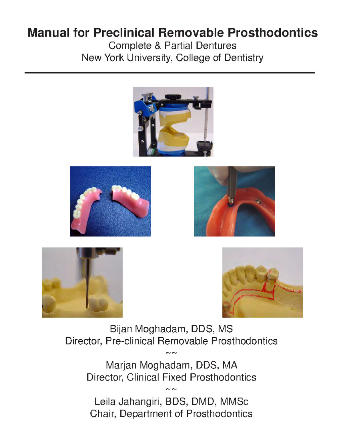 RPD NYU Manual: Complete & Partial Denture Techniques - Studocu