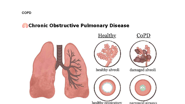 COPD (Chronic Obstructive Pulmonary Disease) Overview and Management ...