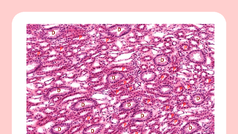 Riñon - Riñón - Microanatomía - P P P P P P P P P P P P P P P P P P P D ...