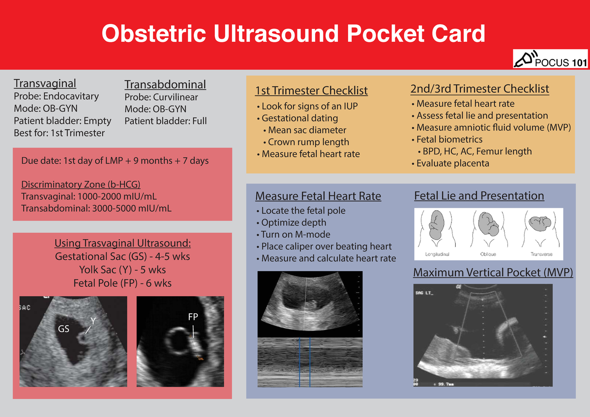 OB Ultrasound Pocket Card: POCUS 101 for 1st Trimester - Studocu