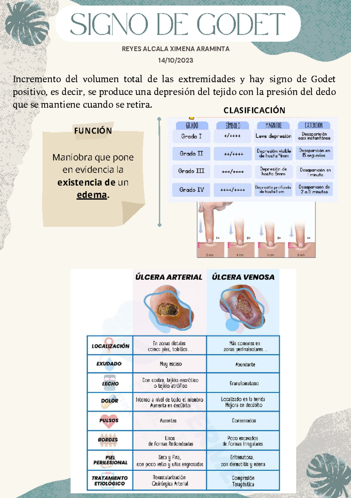 SIGNO DE GODET: Clasificación y Función del Edema en Extremidades - Studocu