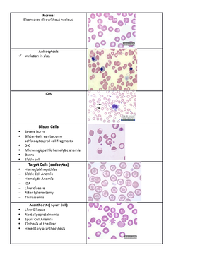 ASO report - Immunoserology Laboratory worksheet (MLT 1500) Name ...