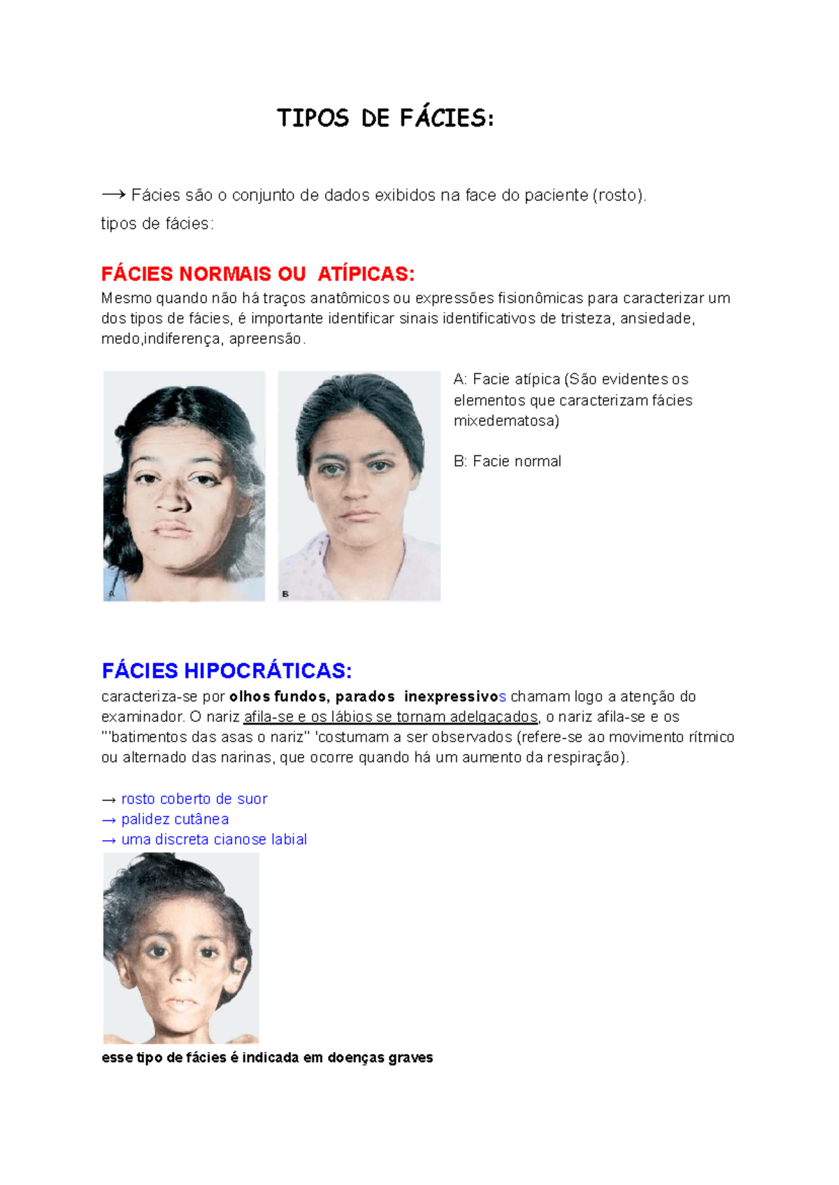 TIPOS DE FÁCIES: Resumo das Principais Fácies Atípicas na Semiologia ...