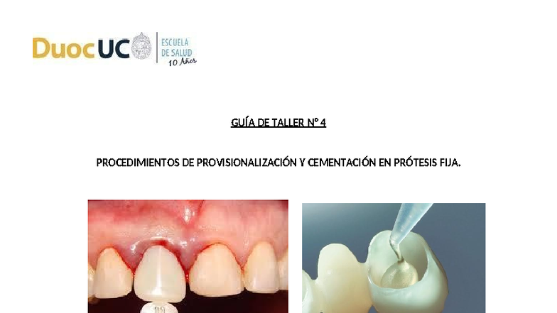 Taller N4: Procedimientos de Provisionalización y Cementación en