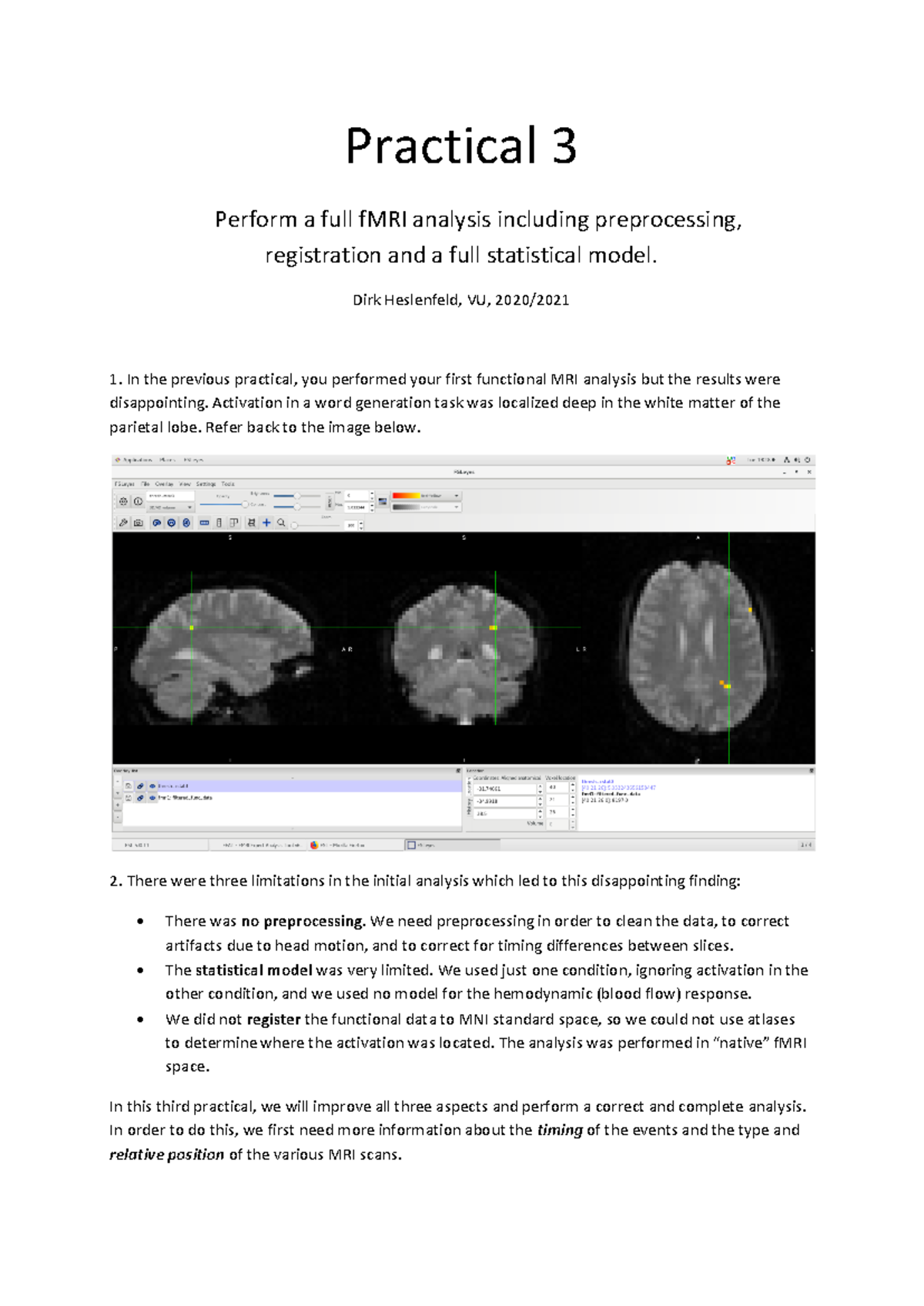MRI Practical 3 - Full fMRI Analysis with Preprocessing & Stats Model ...