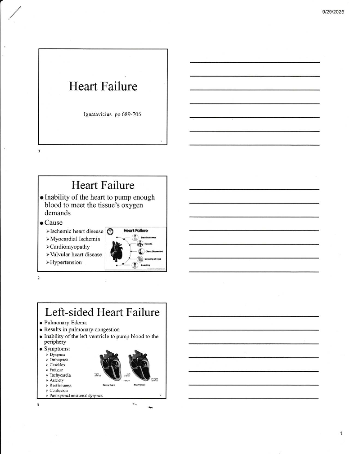 Final Exam Study Guide: Heart Failure Overview (ABC123) - Studocu