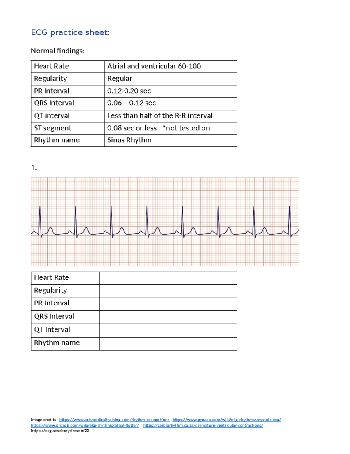 ECG Practice Sheet 3313: Normal Findings & Rhythm Analysis - Studocu