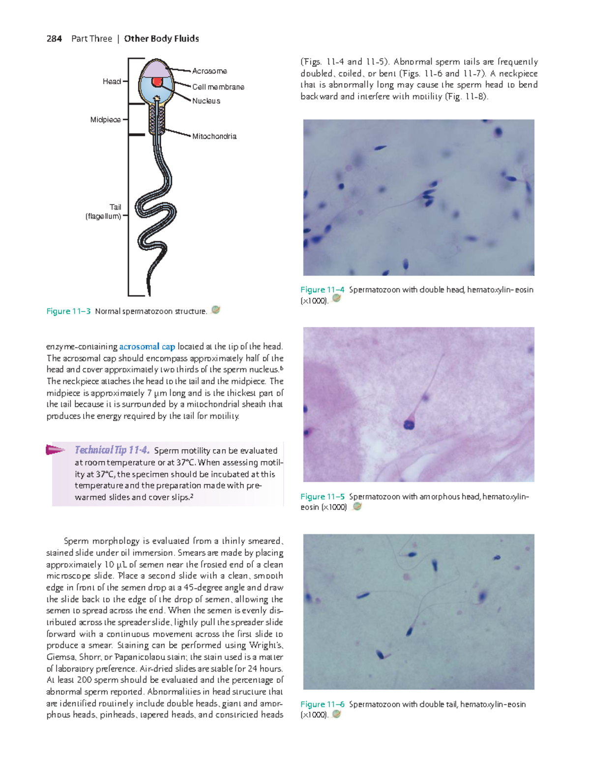 284 Chapter 11: Sperm Morphology and Function Analysis - Studocu