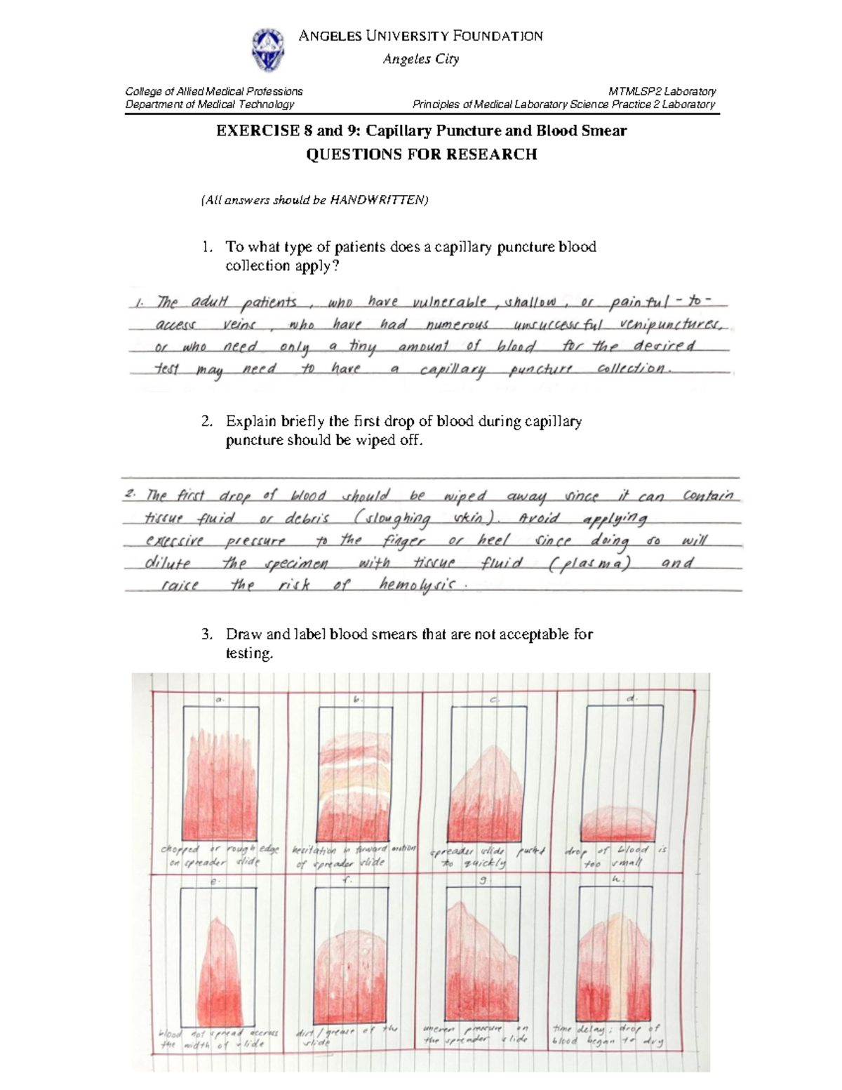 EX8&9 Capillary Puncture and Blood Smear Fontanilla MT2B - Angeles City ...