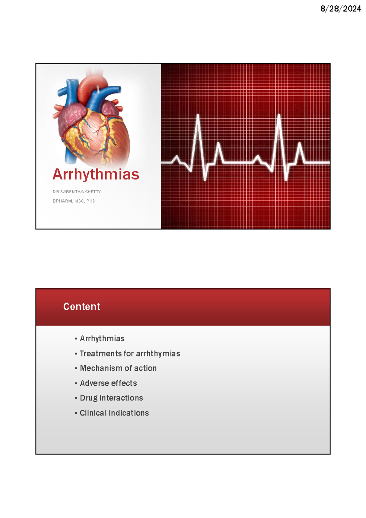 Arrhythmias: Comprehensive Study Notes for BPHARM, MSC, PHD Students ...
