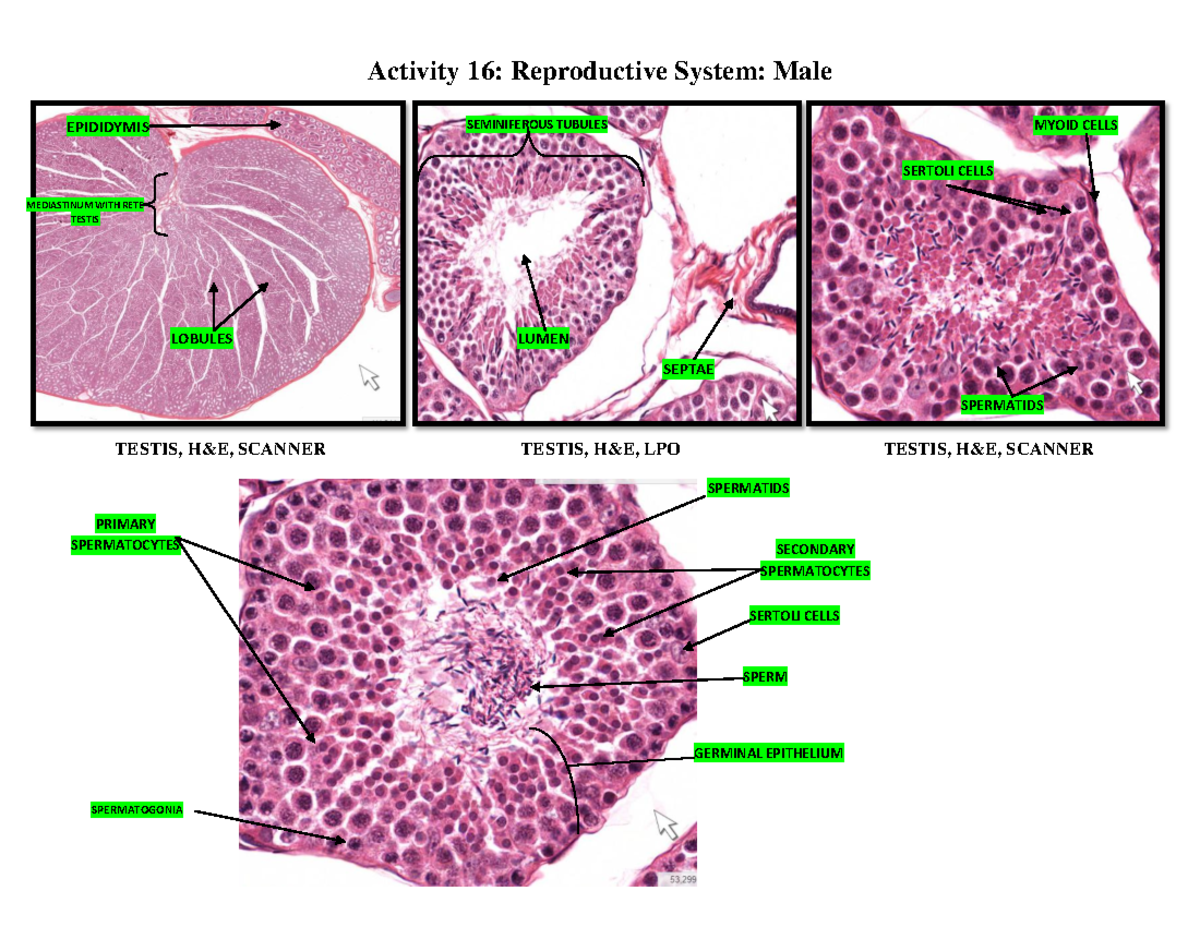 Histopathology of Male Reproductive System - Comprehensive Overview ...