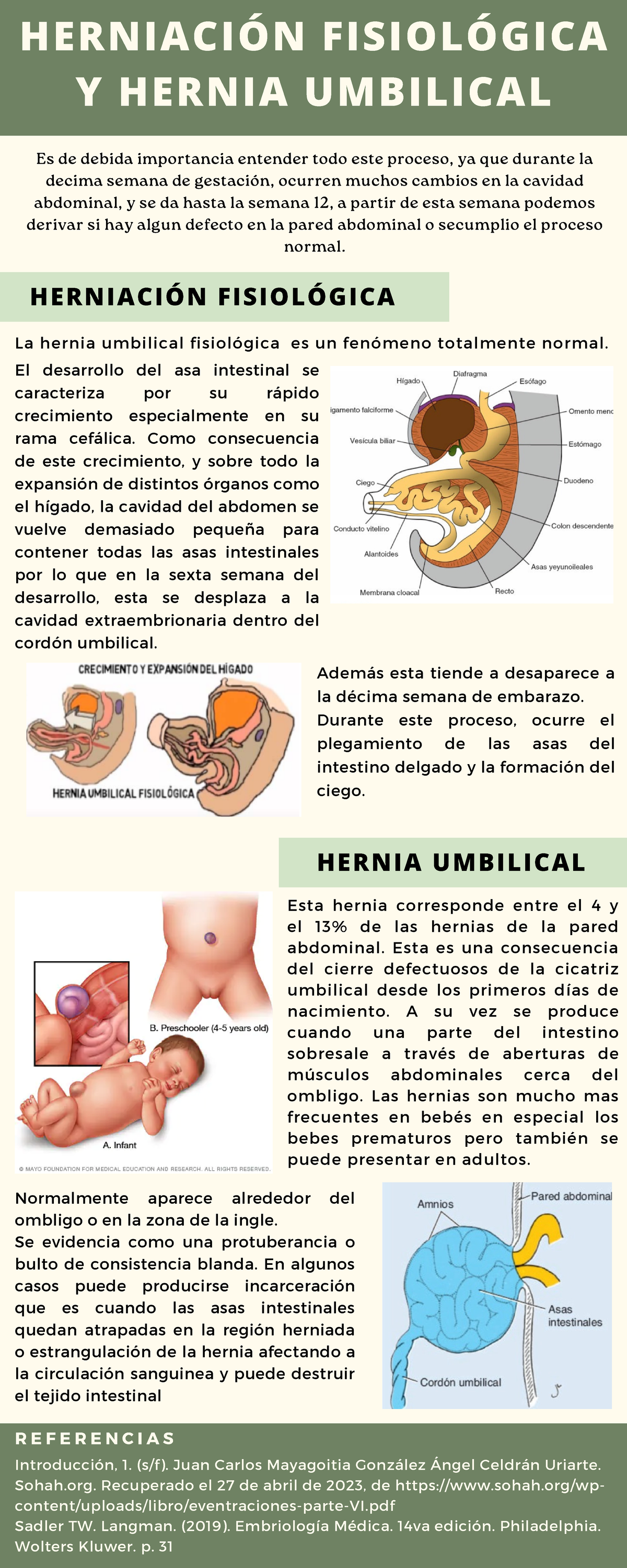 Infografía sobre Herniación Fisiológica y Hernia Umbilical - Studocu