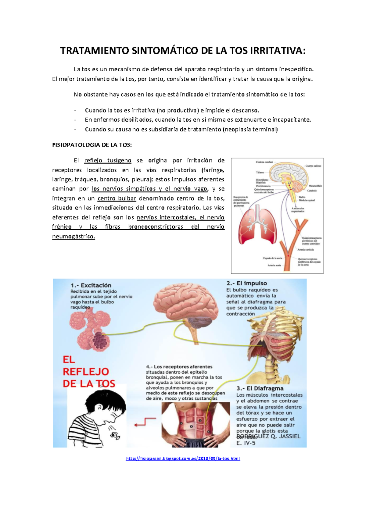 Tratamiento de la Tos Irritativa y Reflejo Tusígeno en Neurología - Studocu