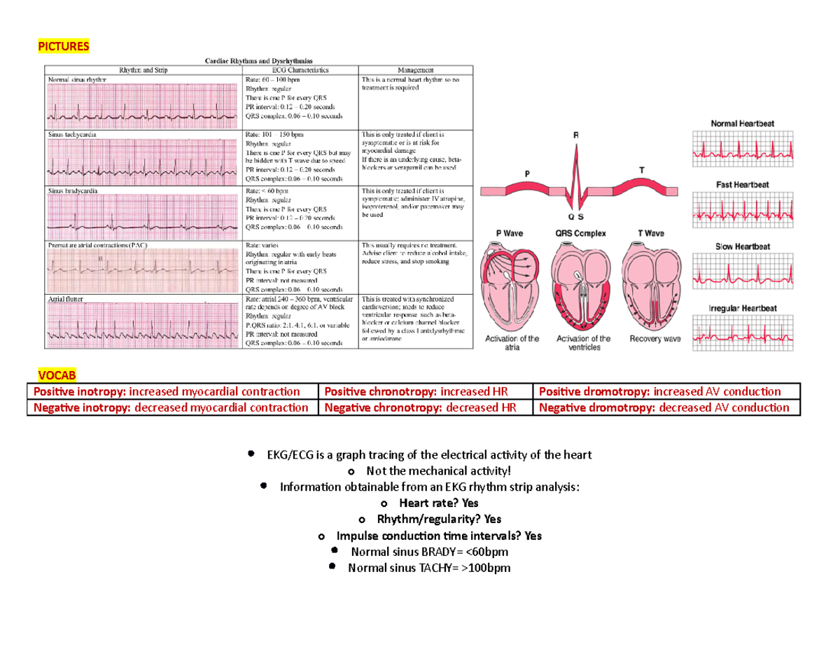 Cardiac Dysrhythmias Study Chart - PICTURES VOCAB Positive inotropy ...