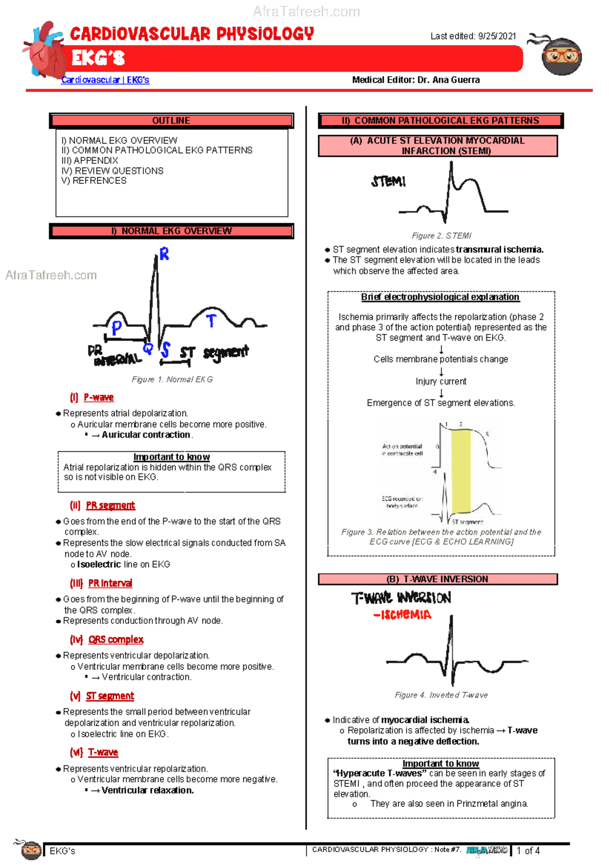 Cardiovascular EKG Patterns: A Comprehensive Overview (MED 7) - Studocu