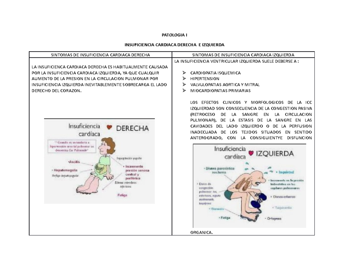 Cuadro Comparativo Insuficiencia Cardiaca Derecha VS Izquierda