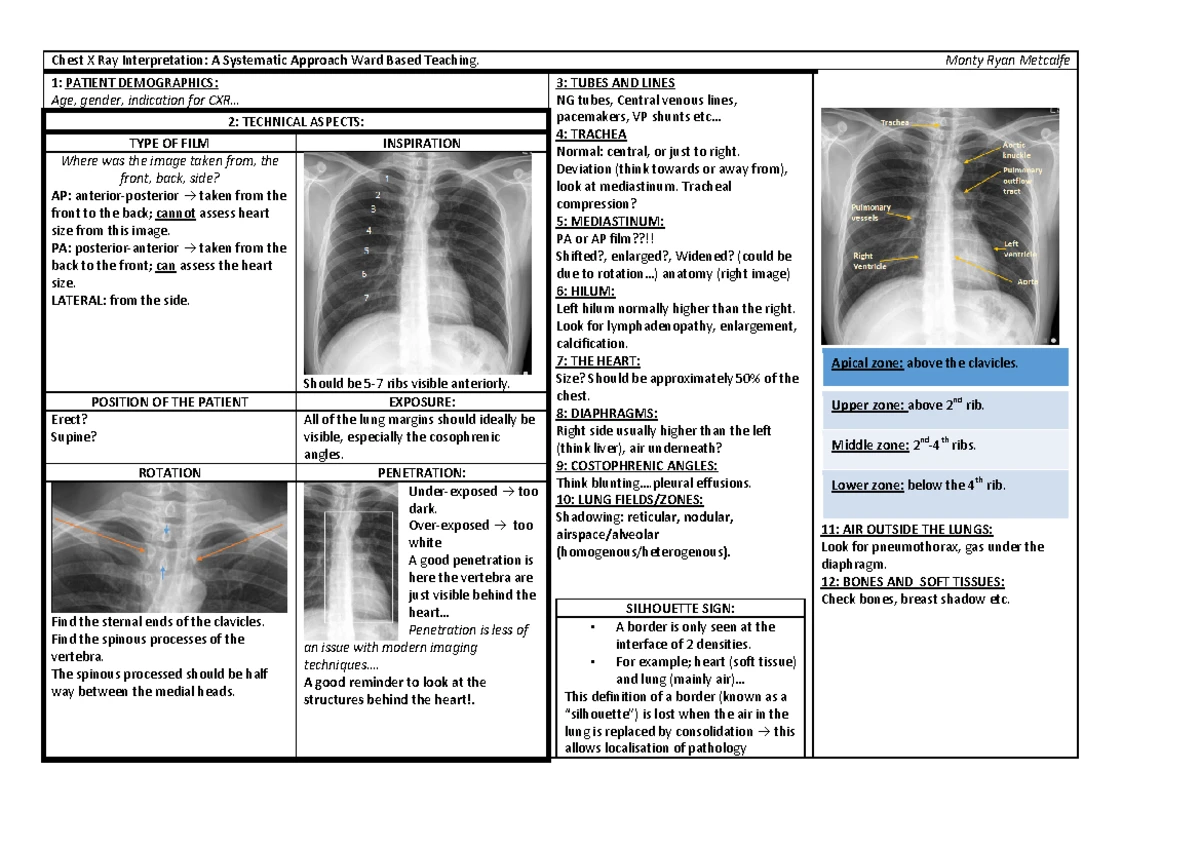 Interpretating CXR - Interpretation Chest X-Rays The most important X ...