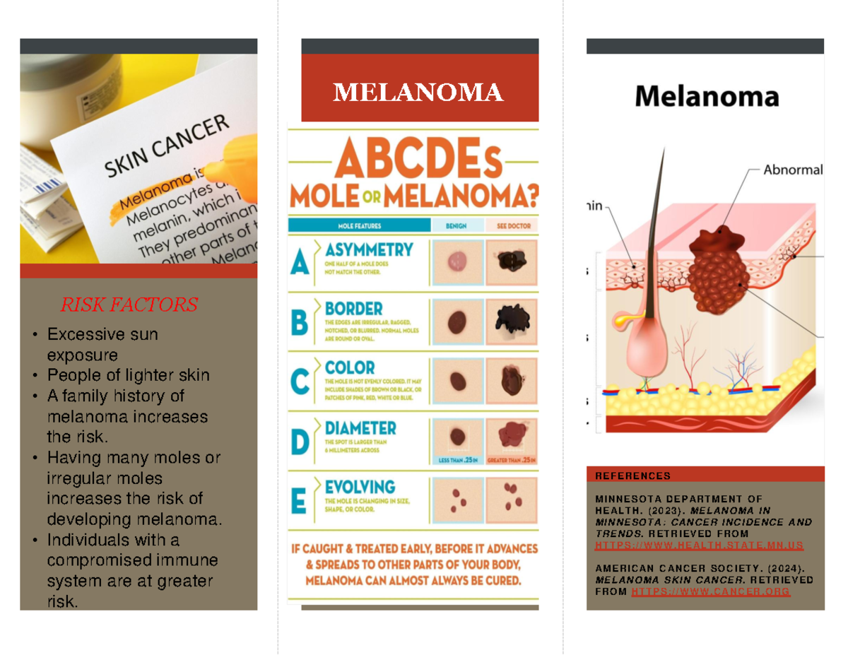 MEL 101: Melanoma Risk Factors and Prevention Strategies - Studocu