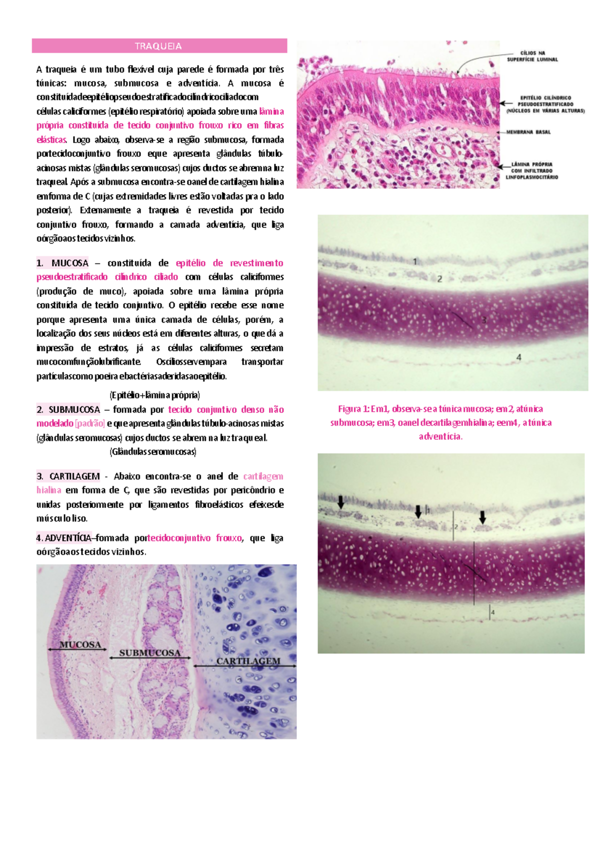 Histologia - Traqueia E Pulmão - TRAQUEIA A traqueia é um tubo flexível  cuja parede é formada por - Studocu