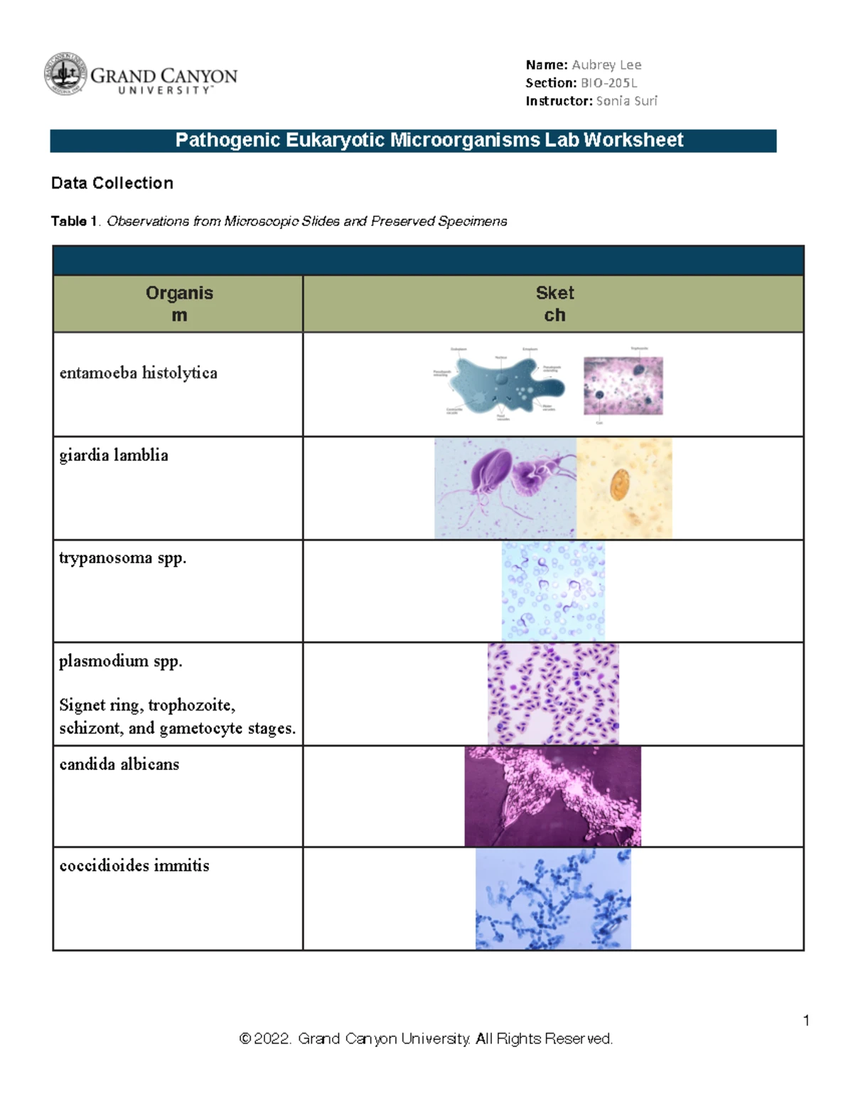 Pathogenic Eukaryotic Microorganisms Sec(on: BIO 205 L Instructor