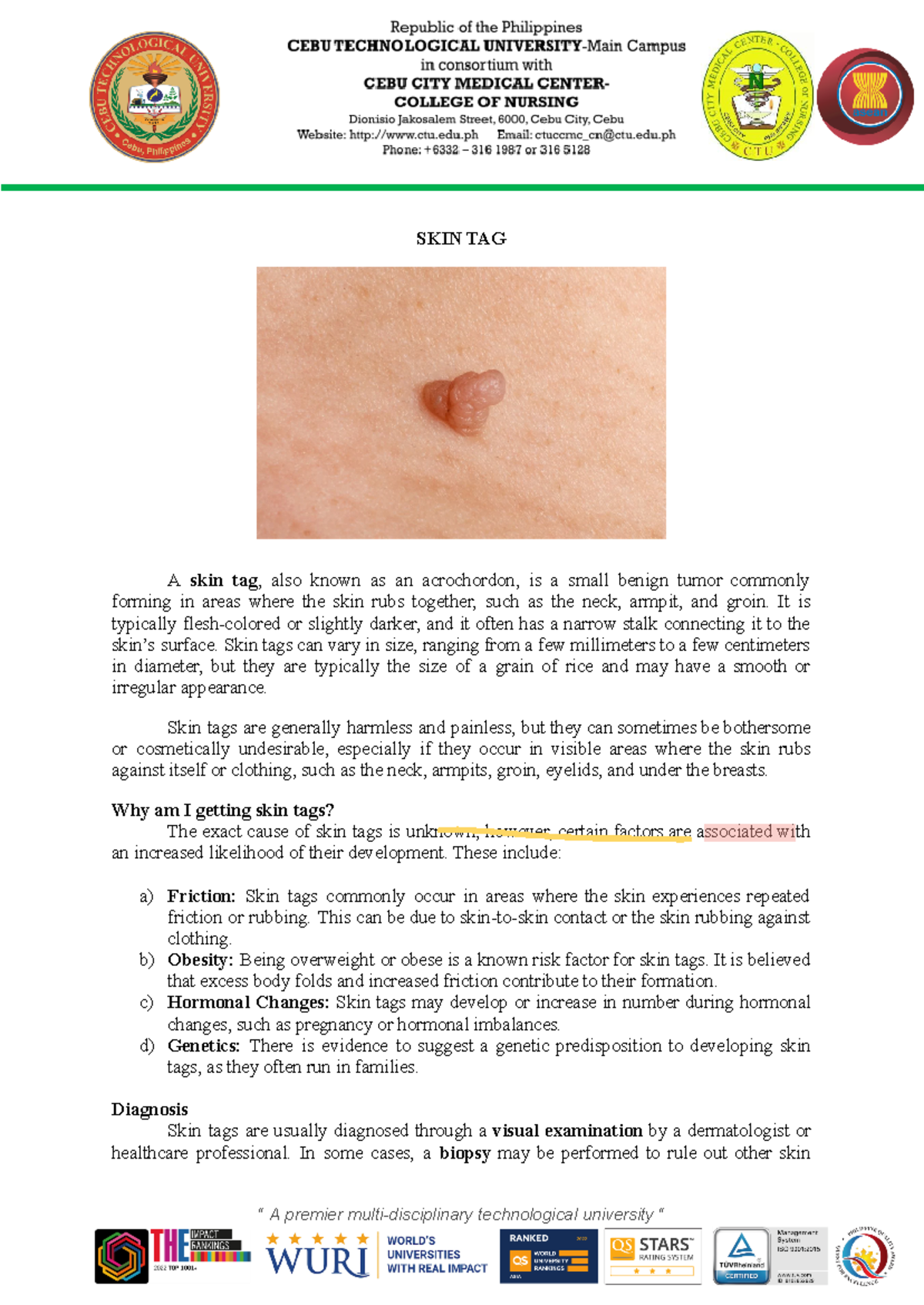 Minor Surgery: Understanding and Managing Skin Tags - Studocu
