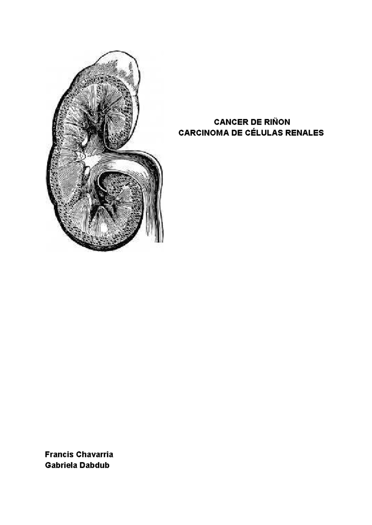CANCER DE RIÑON: CARCINOMA DE CÉLULAS RENALES - GENERALIDADES Y ...