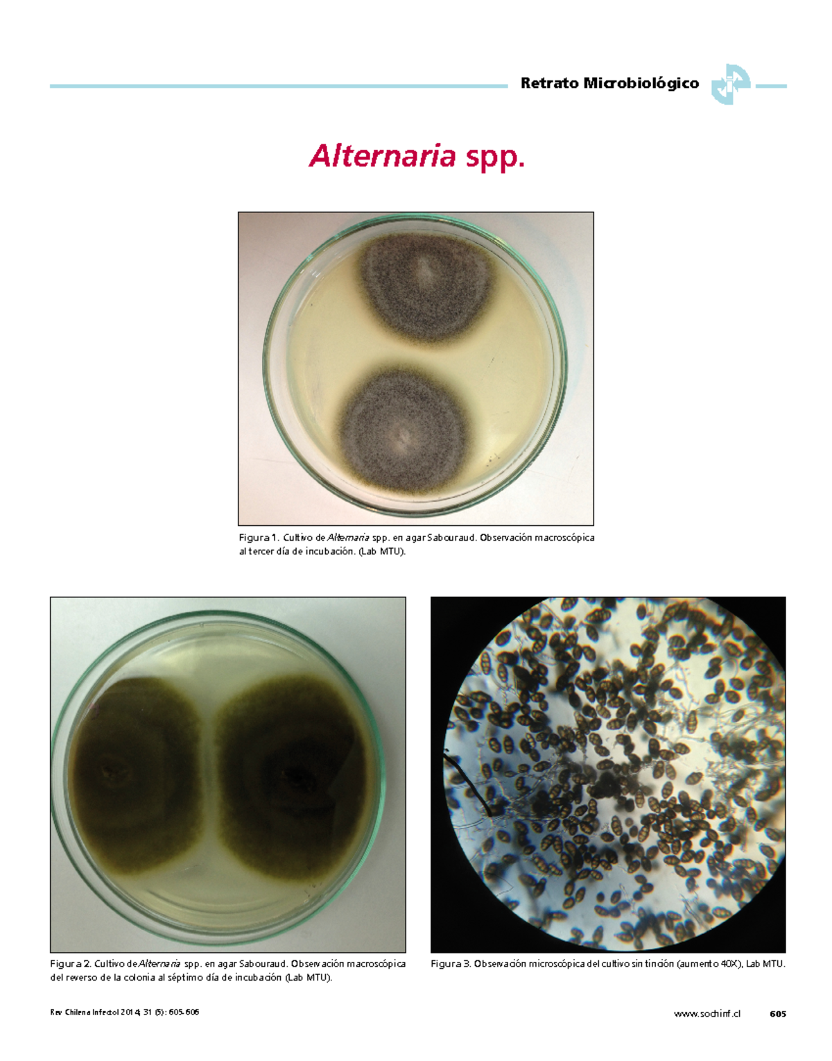 Observación Microscópica de Alternaria spp. - MICROSCOPIO - Studocu