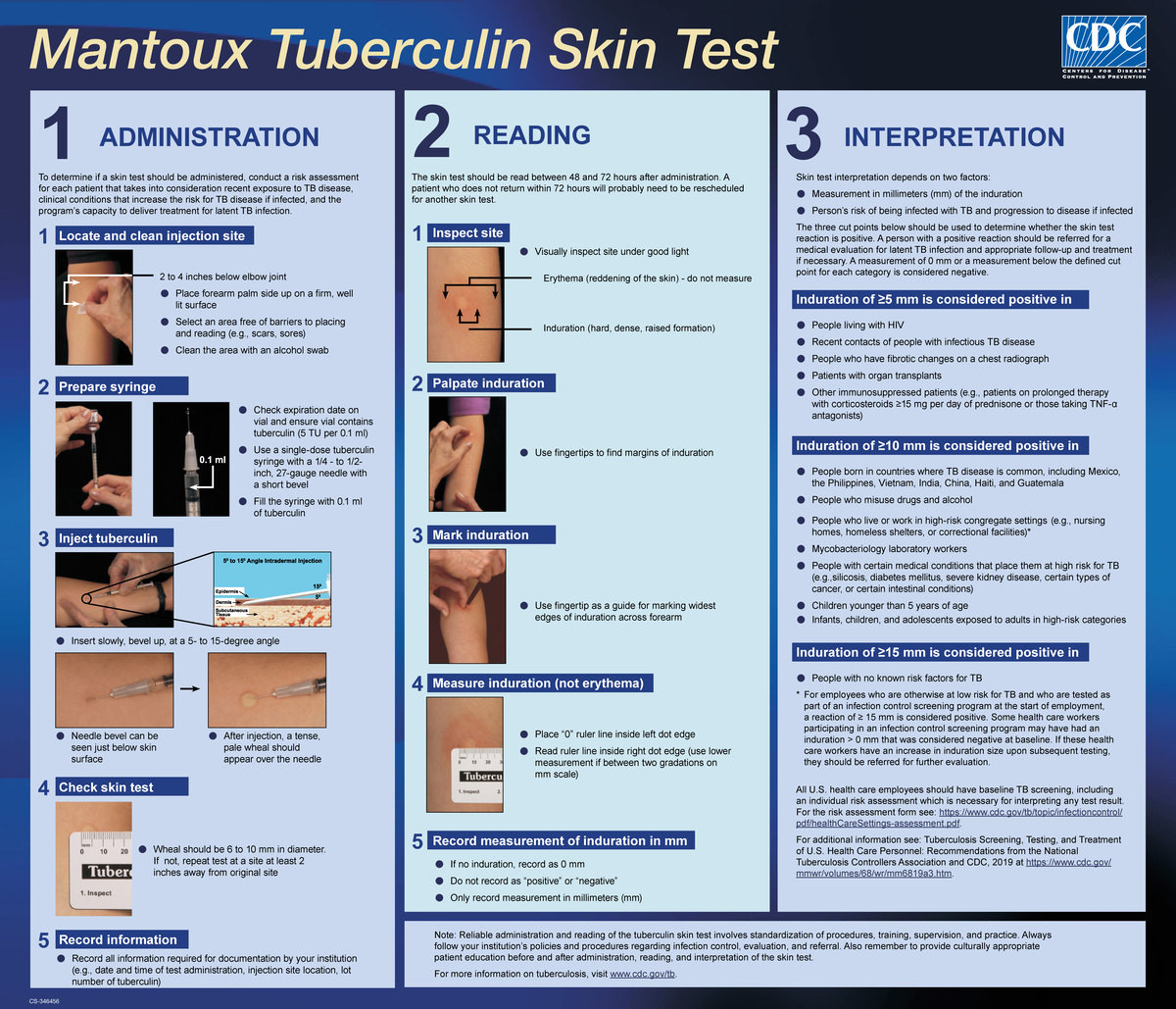 Mantoux Tuberculin Skin Test Guidelines for Effective Administration ...