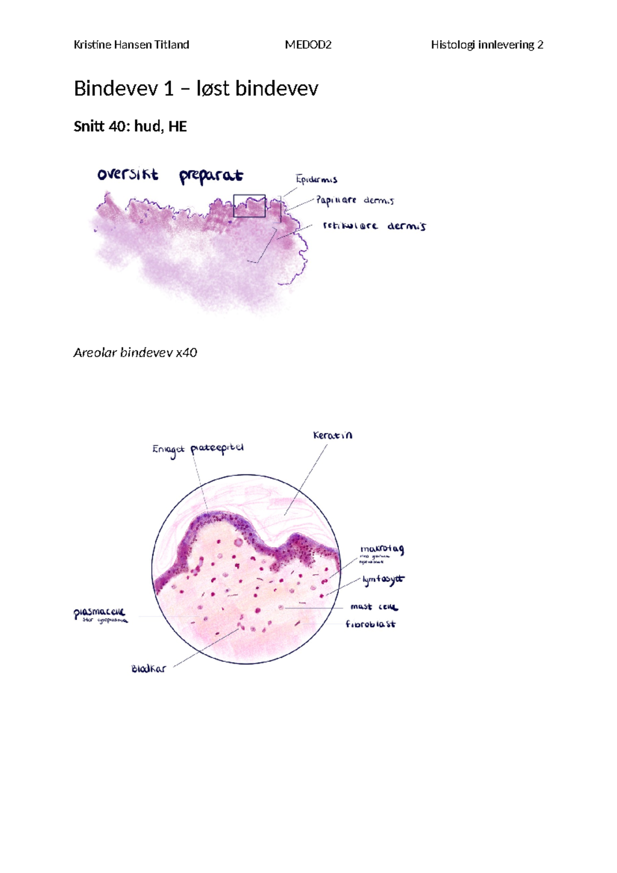 Bindevev - histologi - MEDOD 2 - Kristine Hansen Titland MEDOD2 ...