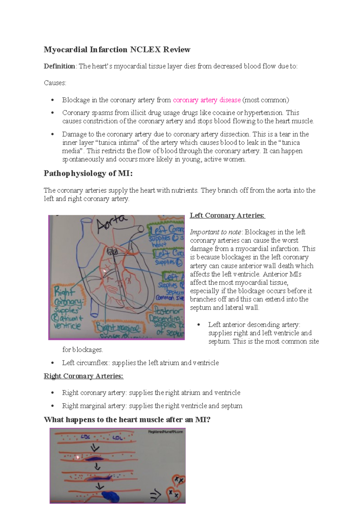 MI - Myocardial Infarction Lecture Notes and Nursing Review - Studocu