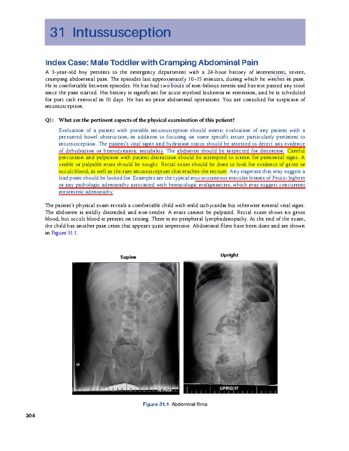 Intussusception Case Study: Male Toddler with Abdominal Pain - Studocu