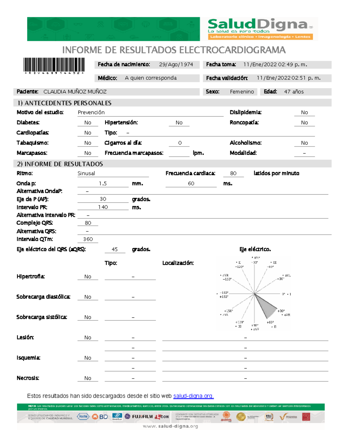 Informe de Electrocardiograma - Salud Digna - RSV468914432 - Document Preview