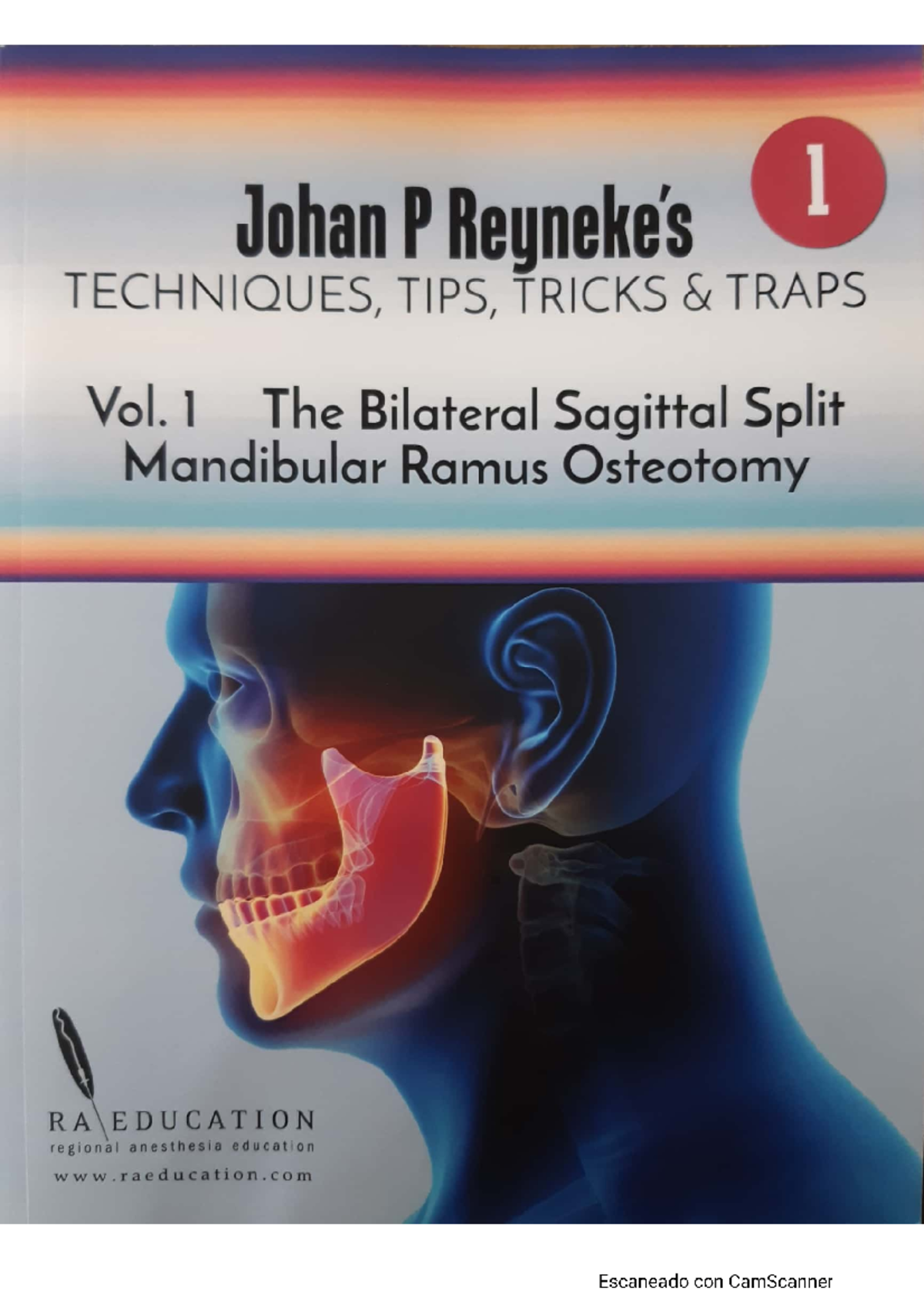 Johan P. Reyneke's Techniques, Tips & Tricks for Bilateral Sagittal ...