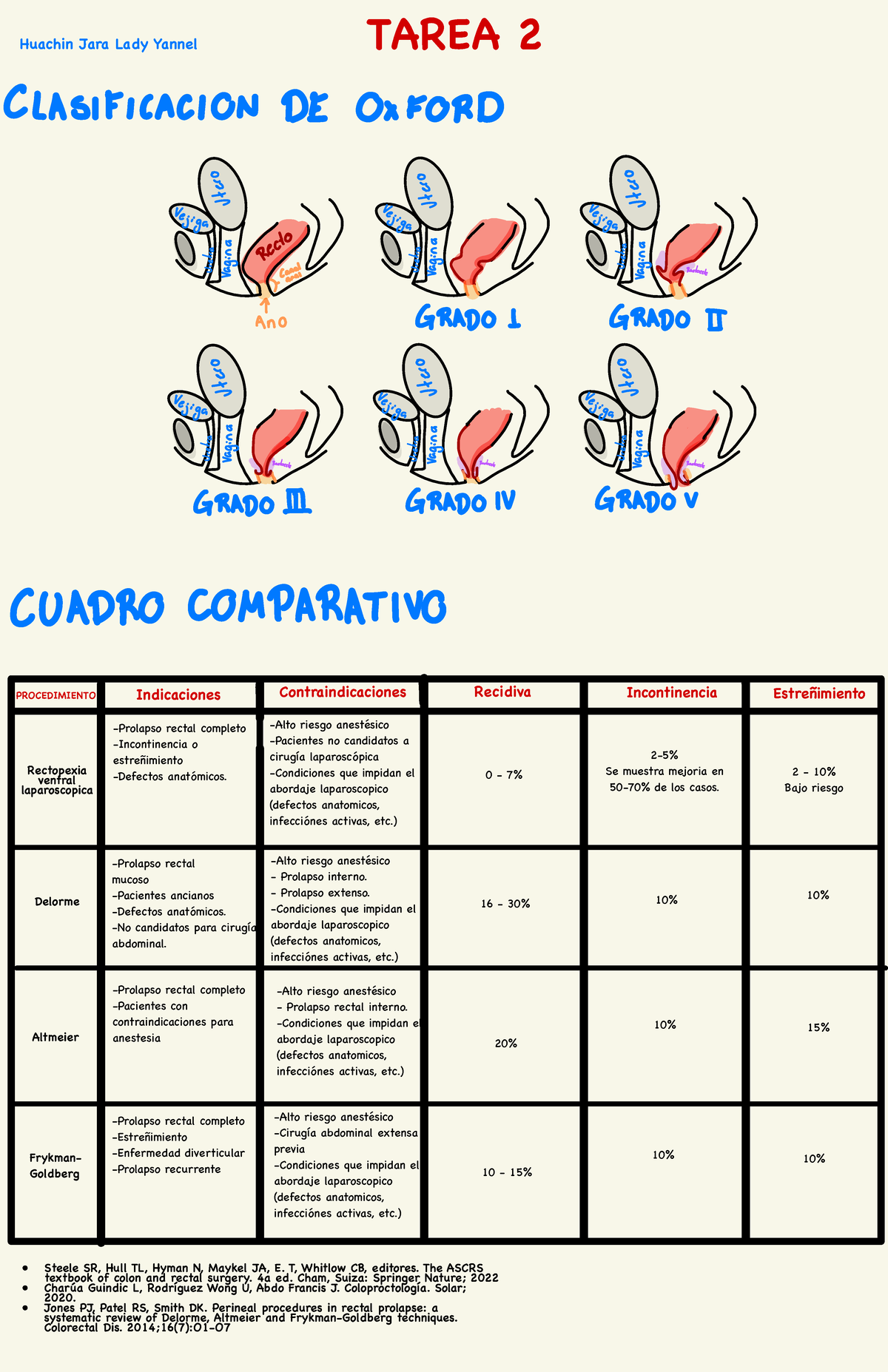 Clasificación y Procedimientos para Prolapso Rectal - TAREA 2 - Studocu