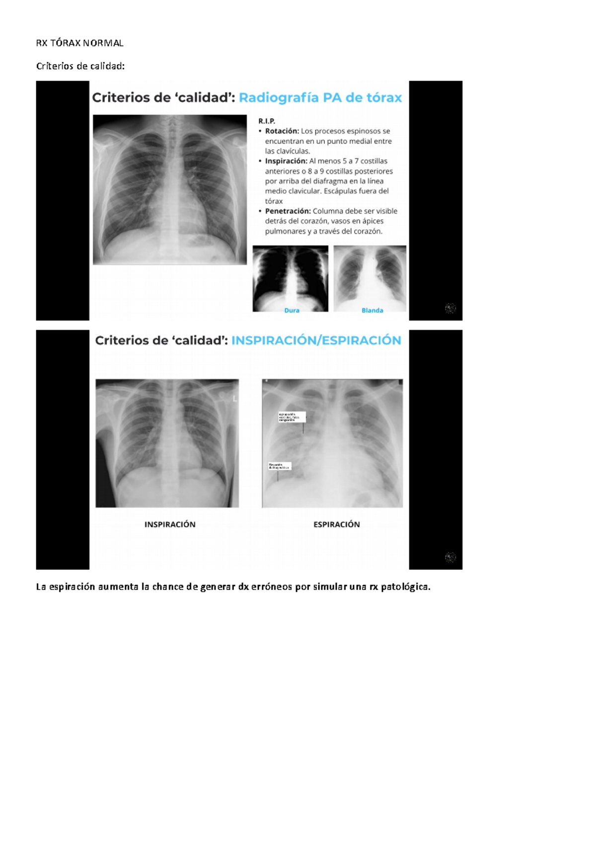 RX Tórax Normal - Resumen Clases de Radiología Clínica - Studocu
