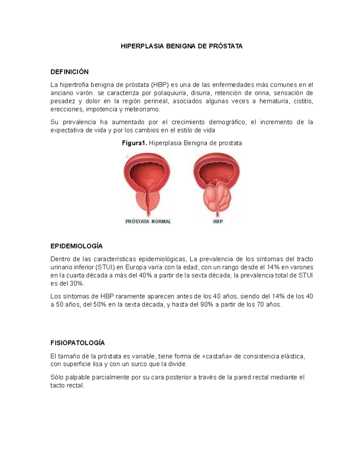 Hiperplasia Benigna Prostática - HIPERPLASIA BENIGNA DE PRÓSTATA ...