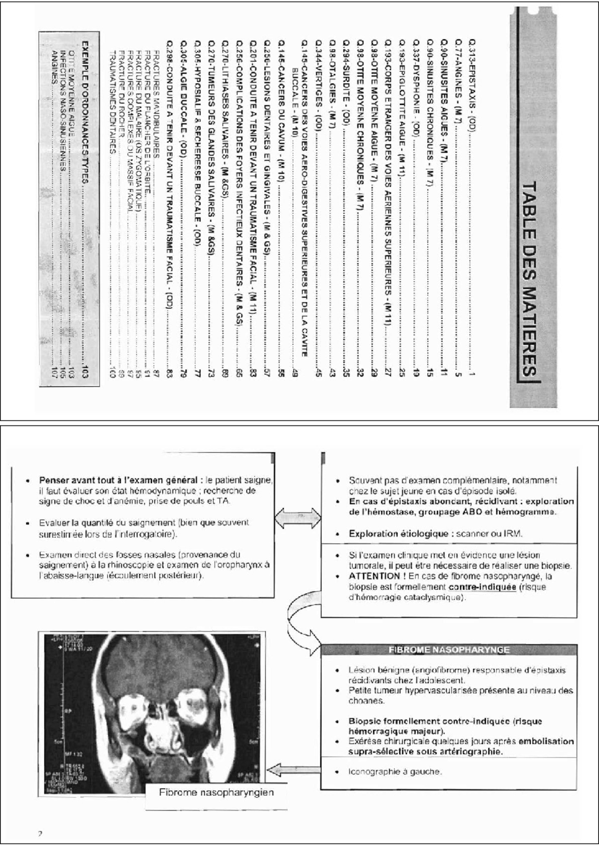 Notes de Cours OTO5 - ORL : Pathologies et Traitements - Studocu
