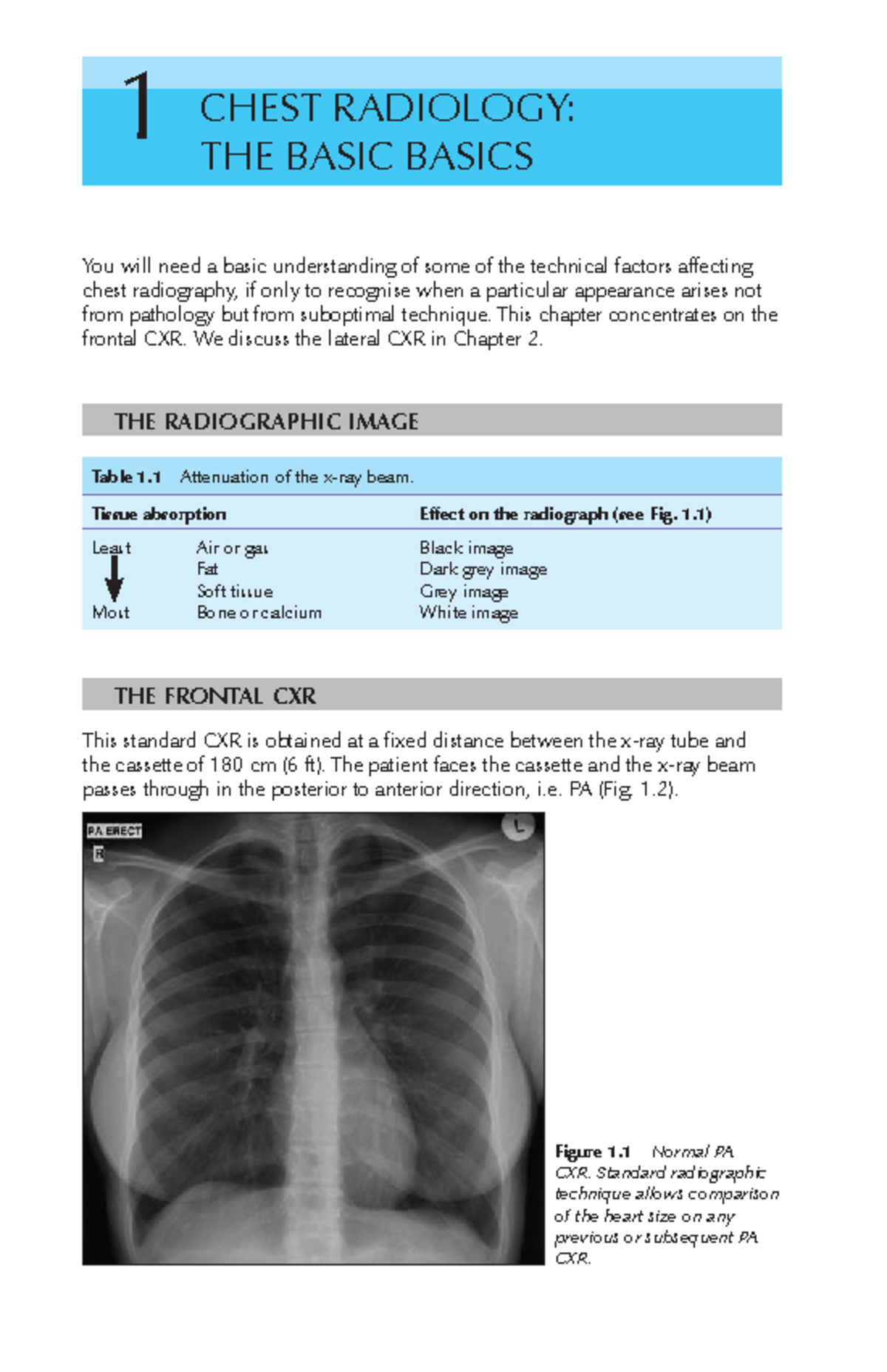 RADIOLOGY 1: CHEST RADIOGRAPHY FUNDAMENTALS - Studocu