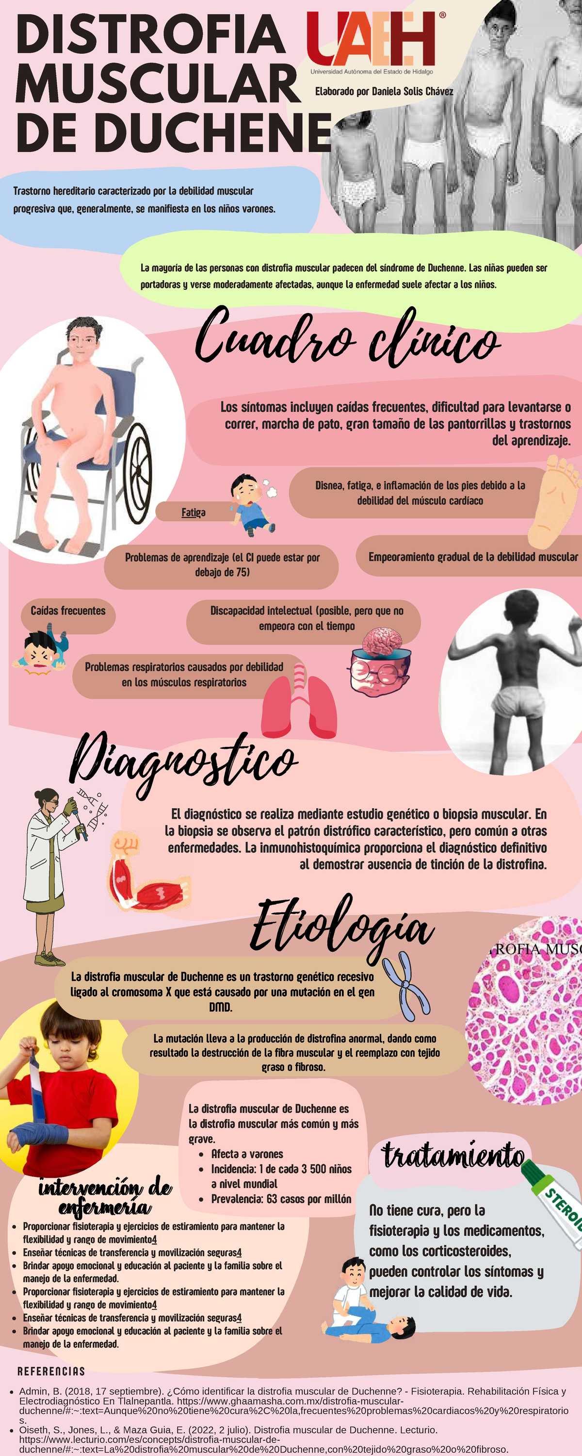 DMD - Distrofia Muscular de Duchenne: Síntomas y Tratamiento - Studocu