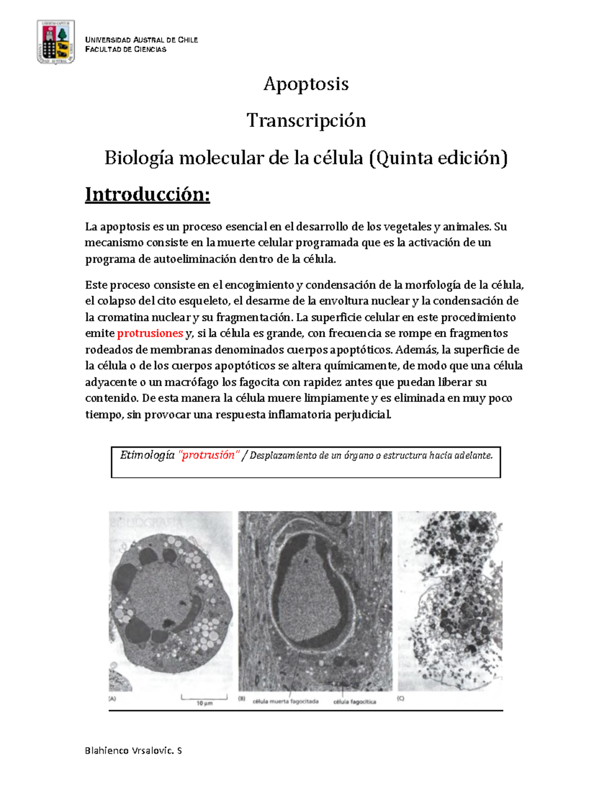 Apoptosis Celular: Mecanismos y Muerte Programada de Células - Document Preview
