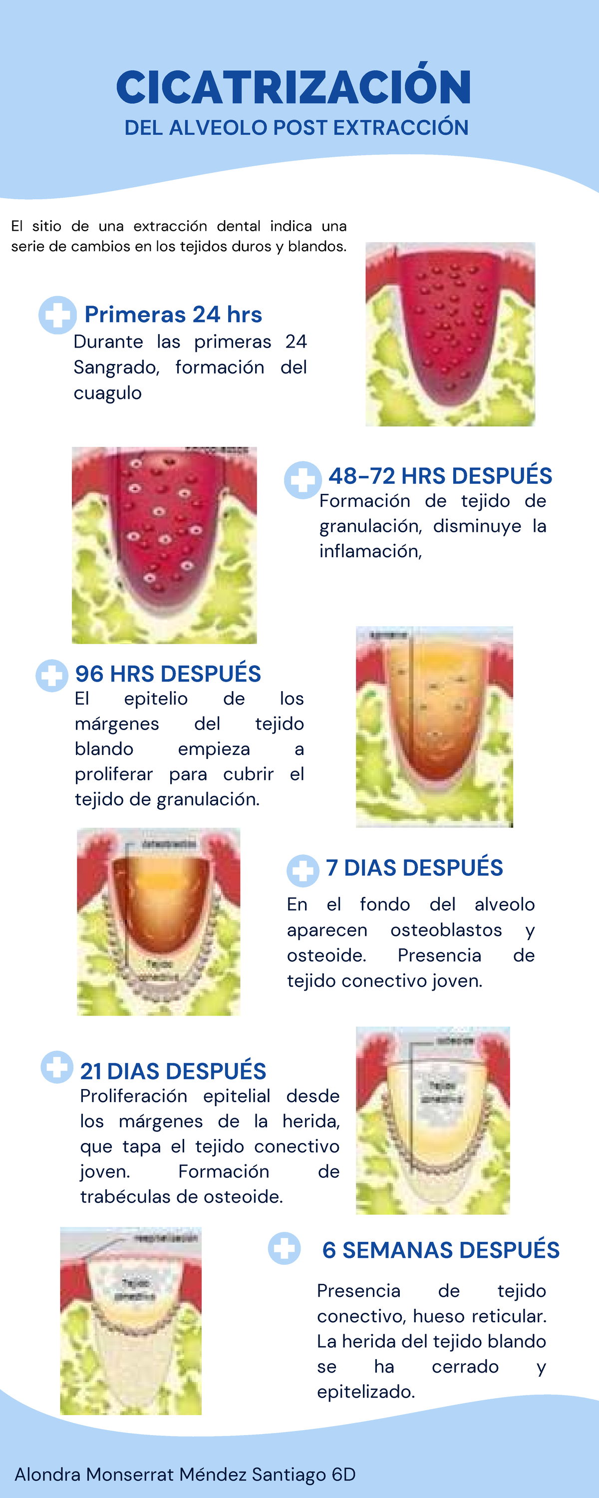 CICATRIZACIÓN DEL ALVEOLO POST EXTRACCIÓN: Proceso y Consejos 6D - Studocu