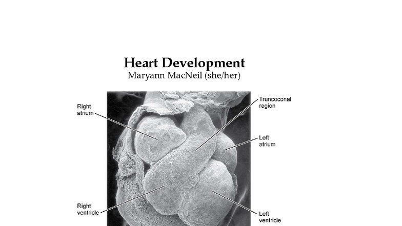 Heart Development Lecture Notes: Cardiogenesis & Septation (BIO 101 ...