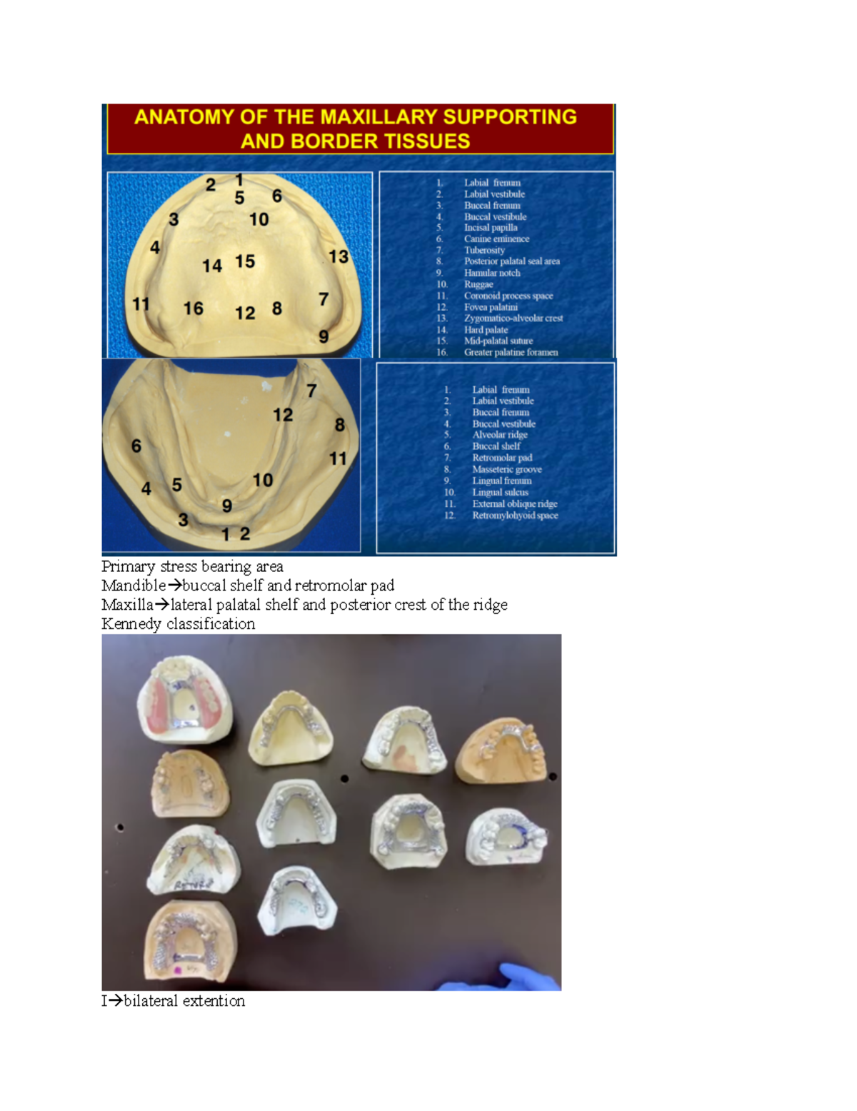RPD 101: Overview of Removable Partial Denture Design Principles - Studocu