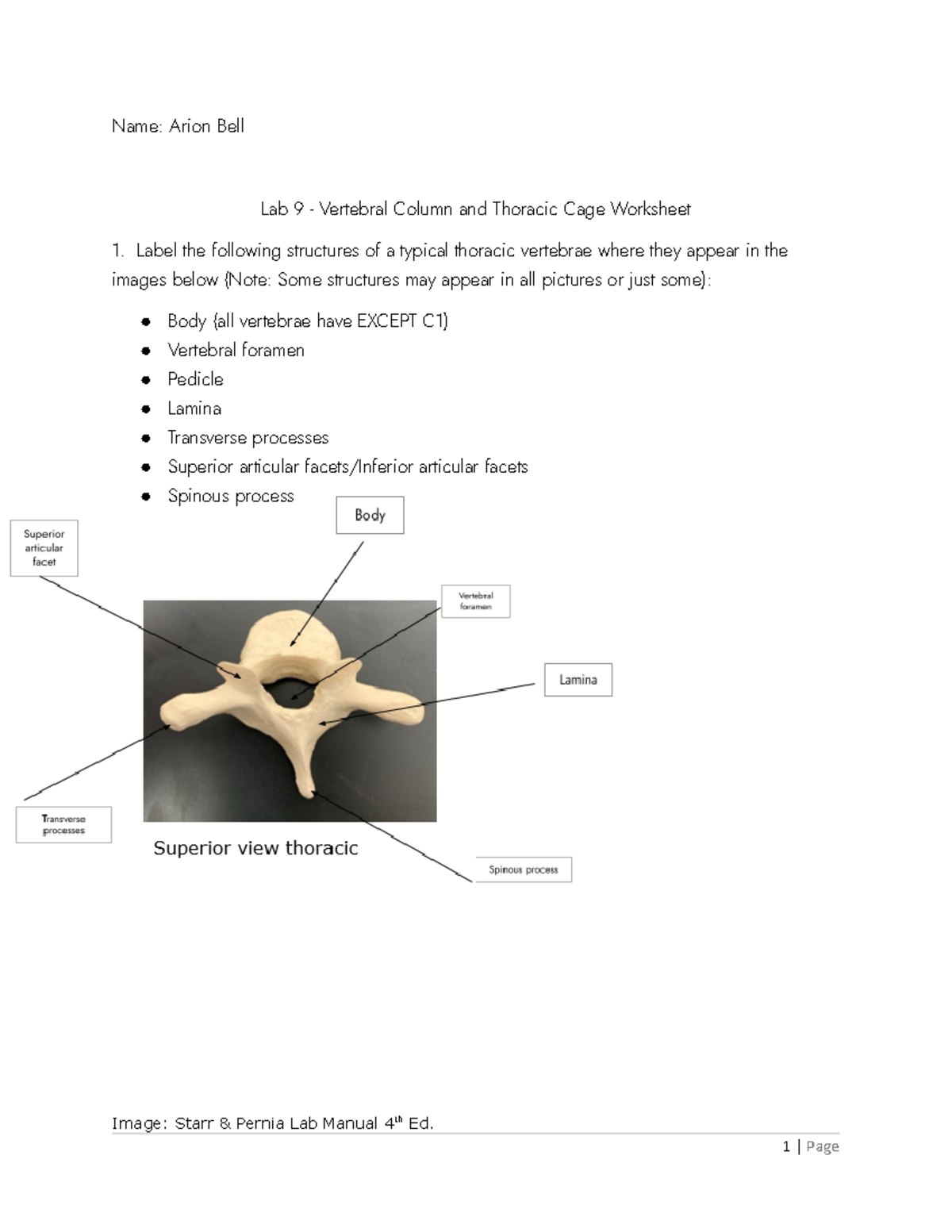 Thoracic Vertebrae Labeled Quiz